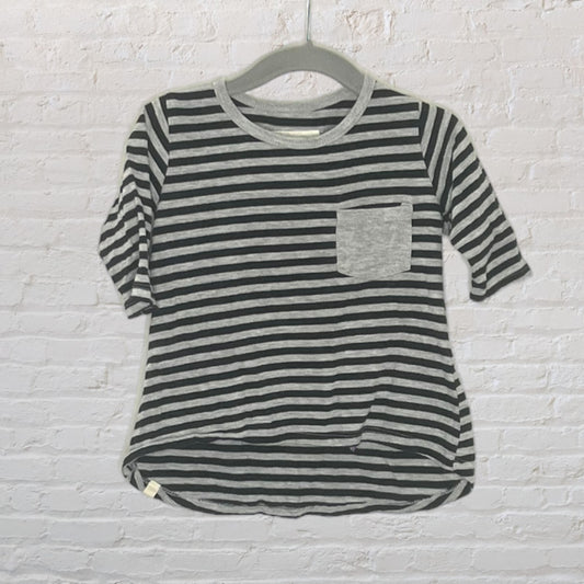 Mini Mioche Striped Tunic (18-24)